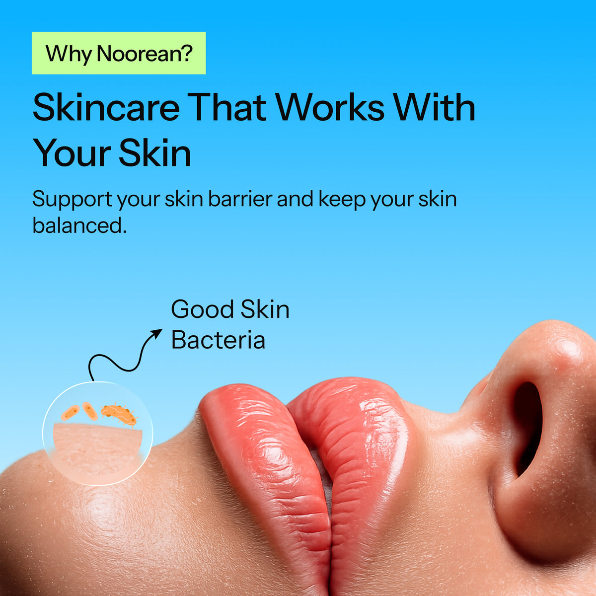 Skin microbiome