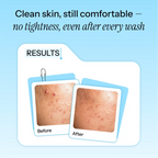 Noorean Gentle Gel Cleanser —  Results