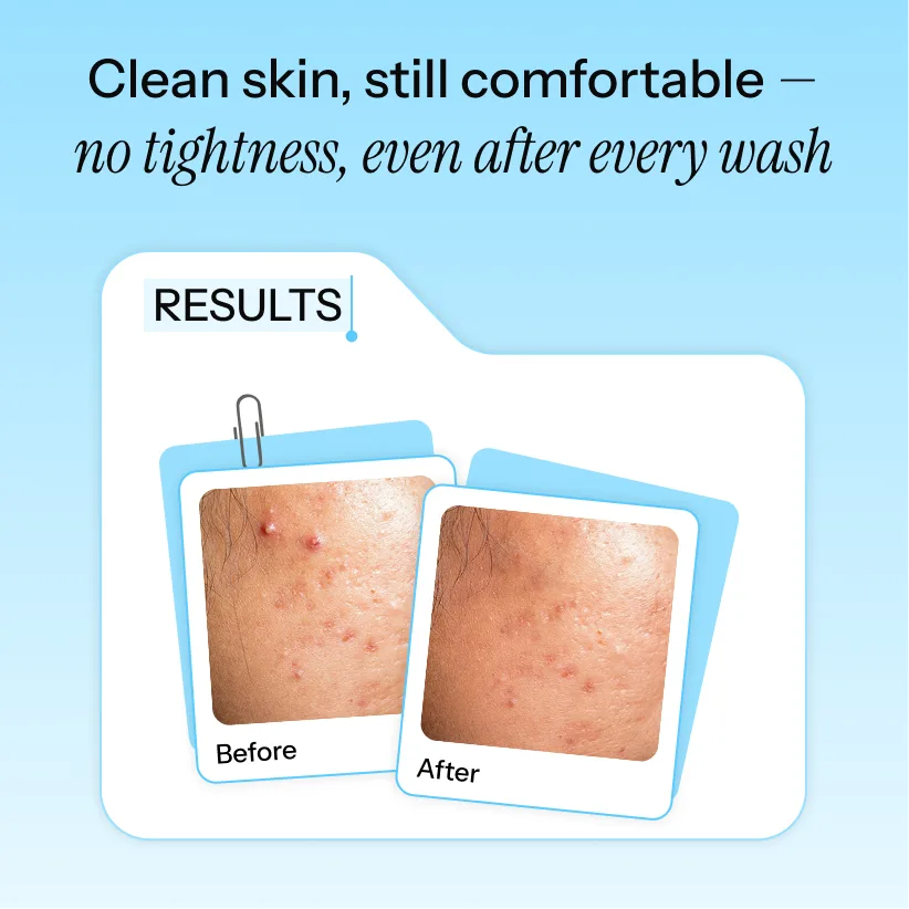 Noorean Gentle Gel Cleanser —  Results